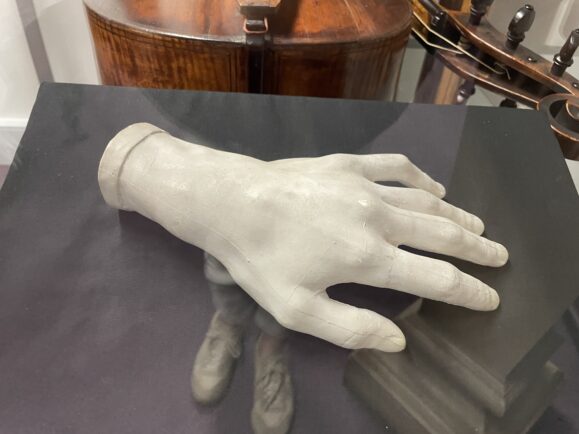 A cast of the composer Chopin's left hand in the Royal Northern College of Music (RNCM) in Manchester's Collection of Historic Musical Instruments